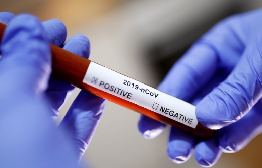 В Угорщині підтвердили перші випадки коронавірусу