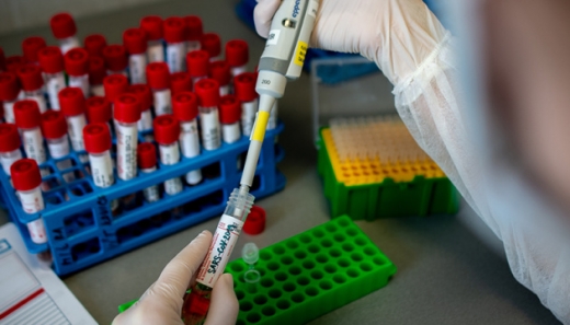 В Україні зафіксовано 310 випадків заражень коронавірусом, за останню добу - 92