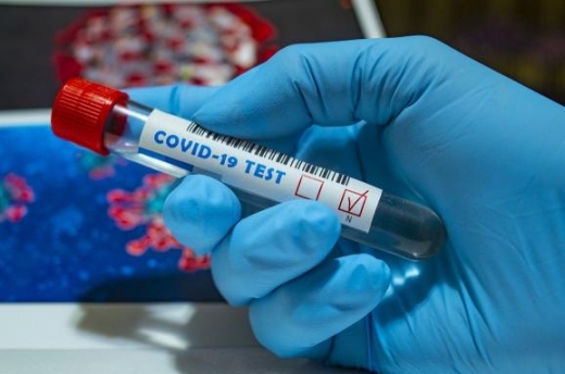 За добу в Ужгороді - 27 нових випадків коронавірусу