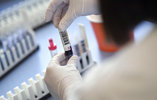 В Ужгороді за добу виявили 31 новий випадок коронавірусу