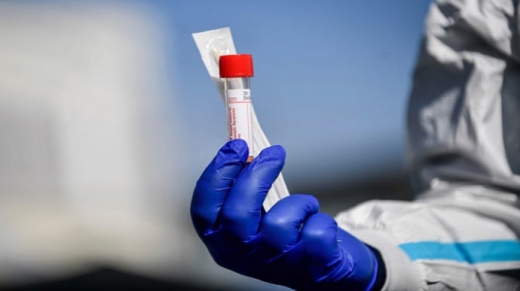 В Ужгороді майже 100 нових випадків коронавірусу