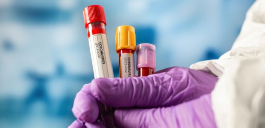 В Ужгороді за добу виявили 93 нові випадки коронавірусної інфекції