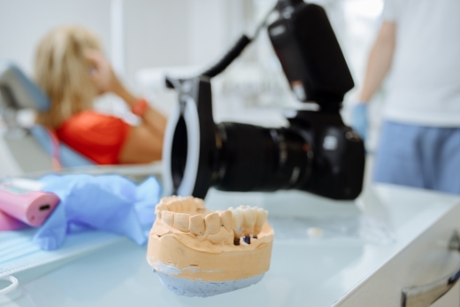 Відновлення жувальної функції та виправлення естетики зубів: спеціальна пропозиція від ужгородських стоматологів