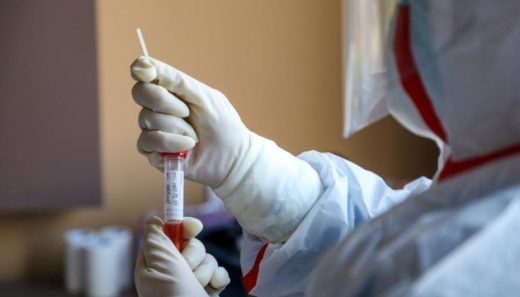 В Ужгороді за добу виявили 13 нових випадків коронавірусу