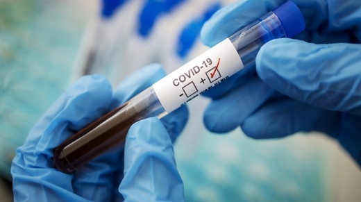 3 нові випадки коронавірусної інфекції виявили в Ужгороді