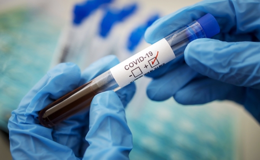 В Ужгороді за добу виявили 51 новий випадок коронавірусної інфекції