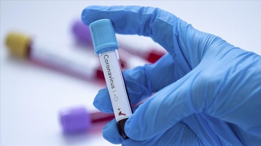 За добу в Ужгороді виявили 31 новий випадок коронавірусу