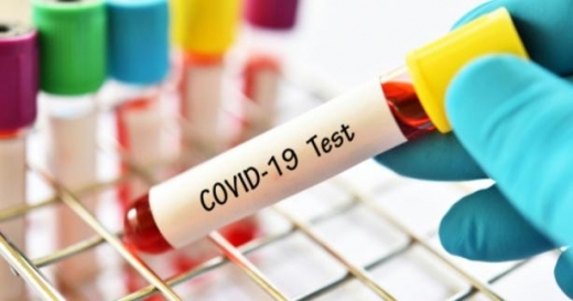 За добу в Ужгороді виявили 71 новий випадок коронавірусу, 1 людина померла 
