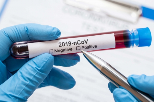 В Ужгороді за добу виявили 74 нові випадки коронавірусної інфекції