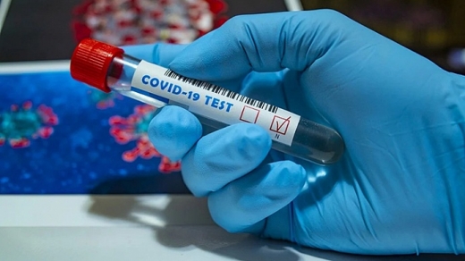 За добу в Ужгороді 132 нові випадки коронавірусу, 1 людина померла